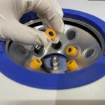 Growth Factor Concentration (GFC) Treatment for Anti-aging: An Advanced PRP Therapy