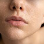 The “Hollywood” way to improve your skin!