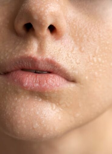 The “Hollywood” way to improve your skin!