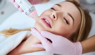 microneedling-rf-modern-SLC-Injections-Aesthetics-in-Salt-Lake-City-Utah