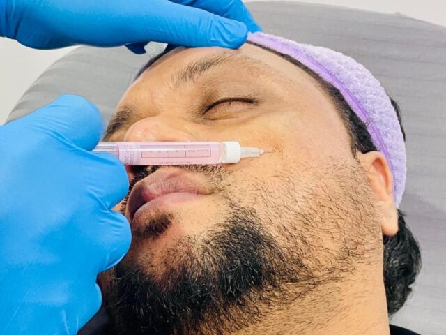 Acne Scars: Why They Form and How Aesthetic Treatments Can Help